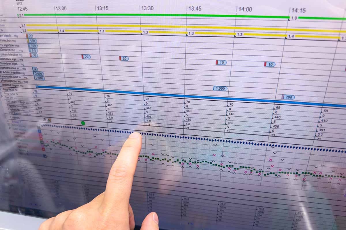 写真付き進捗報告と透明性のある納期管理システム